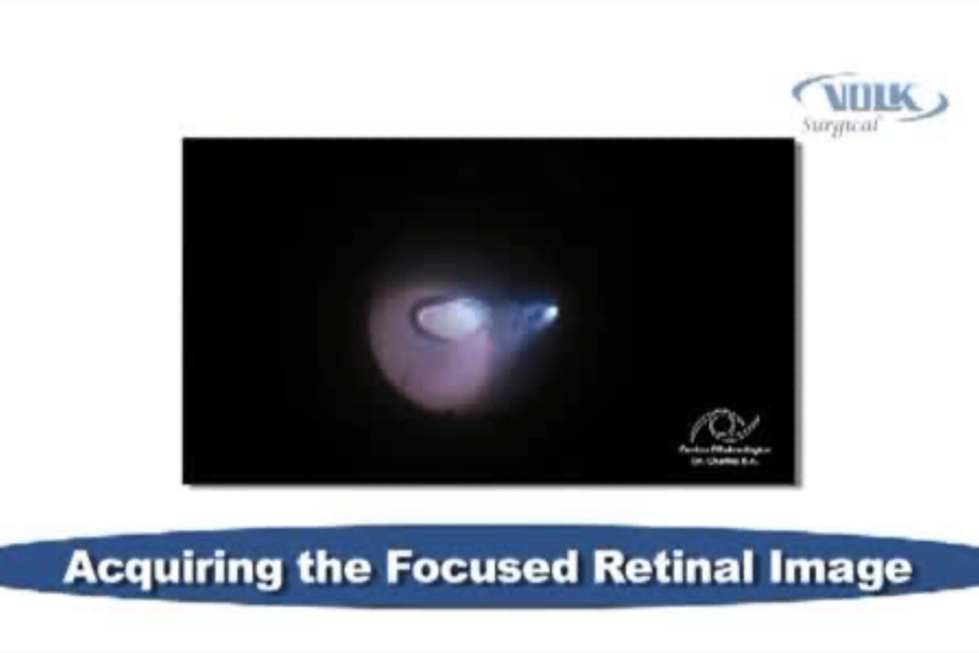 Focused Retinal Image